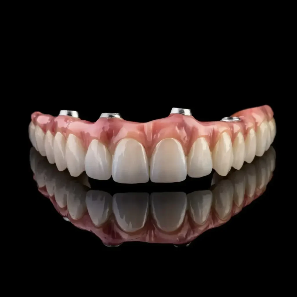 Upper all on 4 dental implant bridge | All-On-4 Dental Implants | "Teeth In a Day"